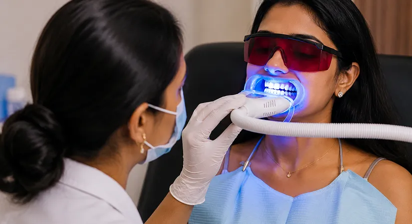 What is Teeth Whitening